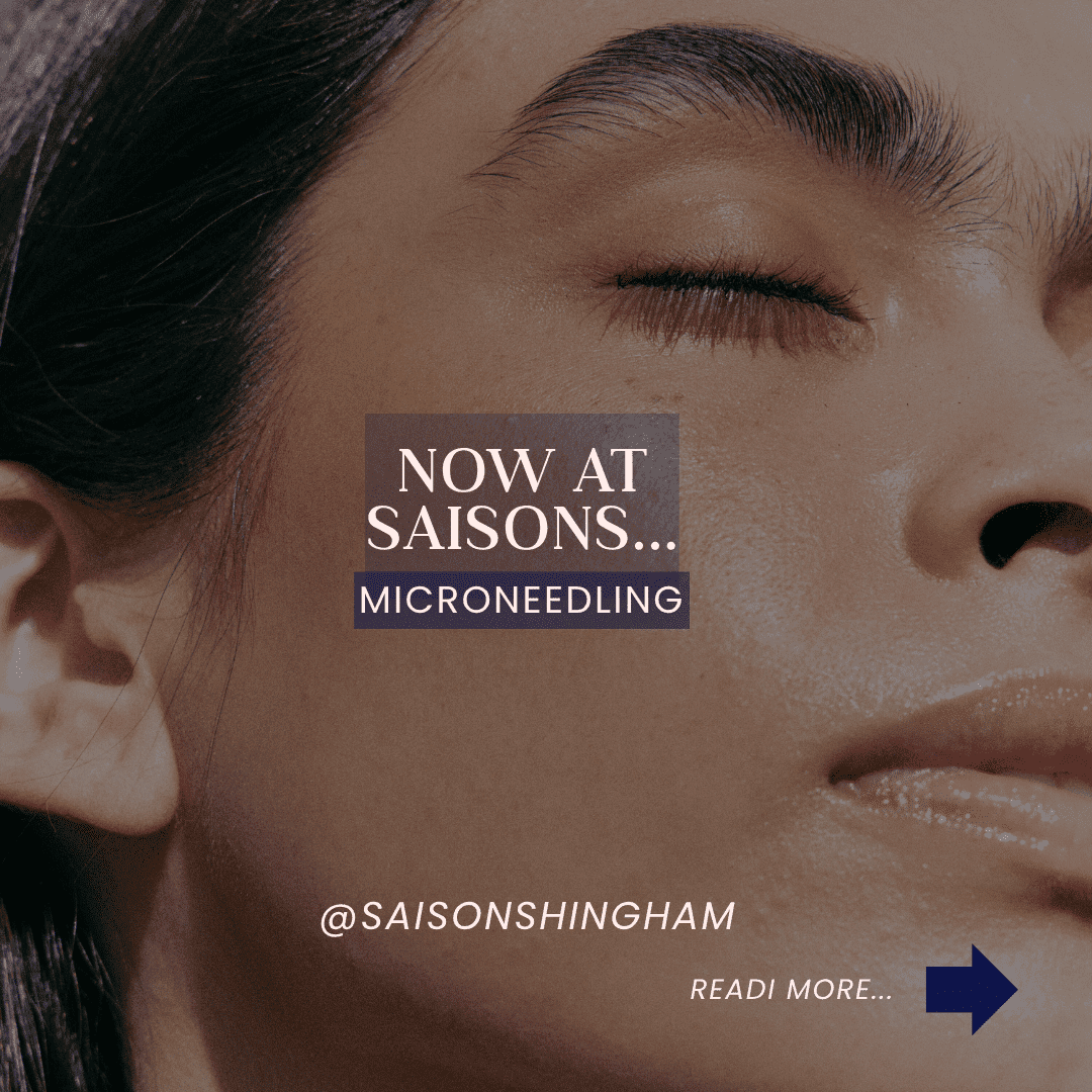 Microneedling available at Saisons. Close-up of a relaxed face with eyes closed.