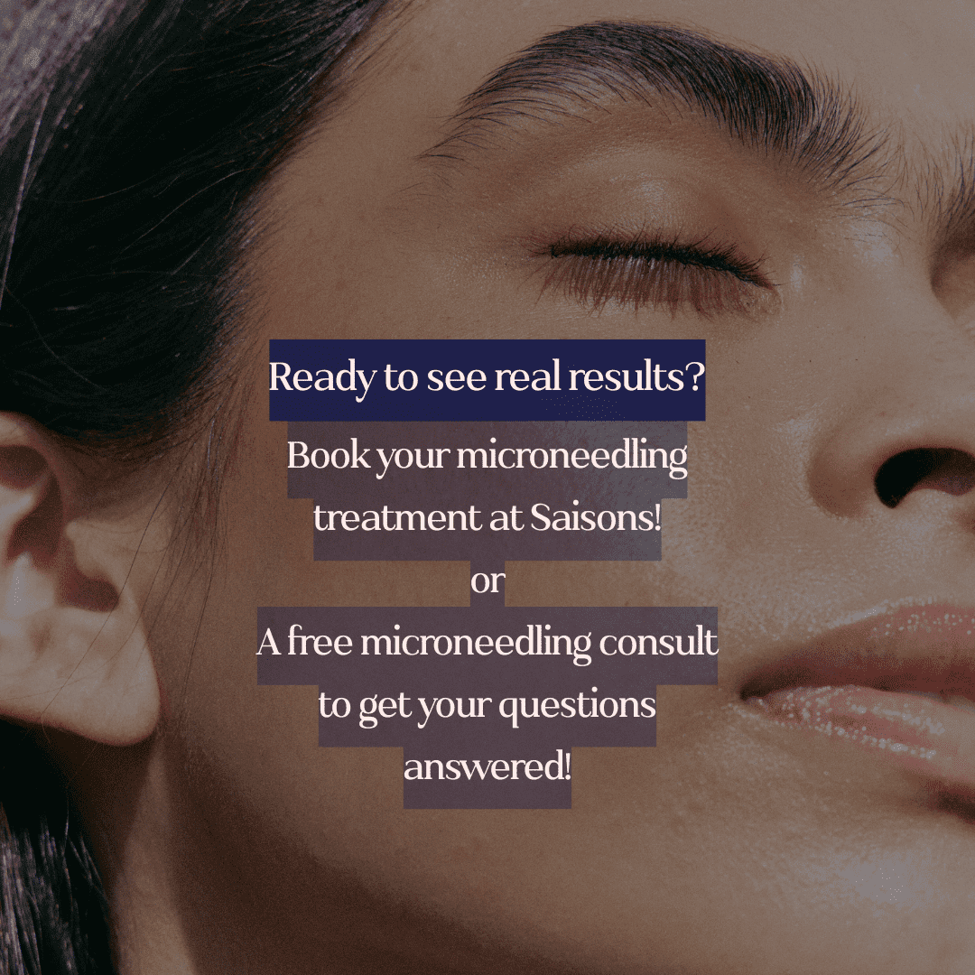 Microneedling treatment and consult offer at Saisons, close-up of a relaxed face.